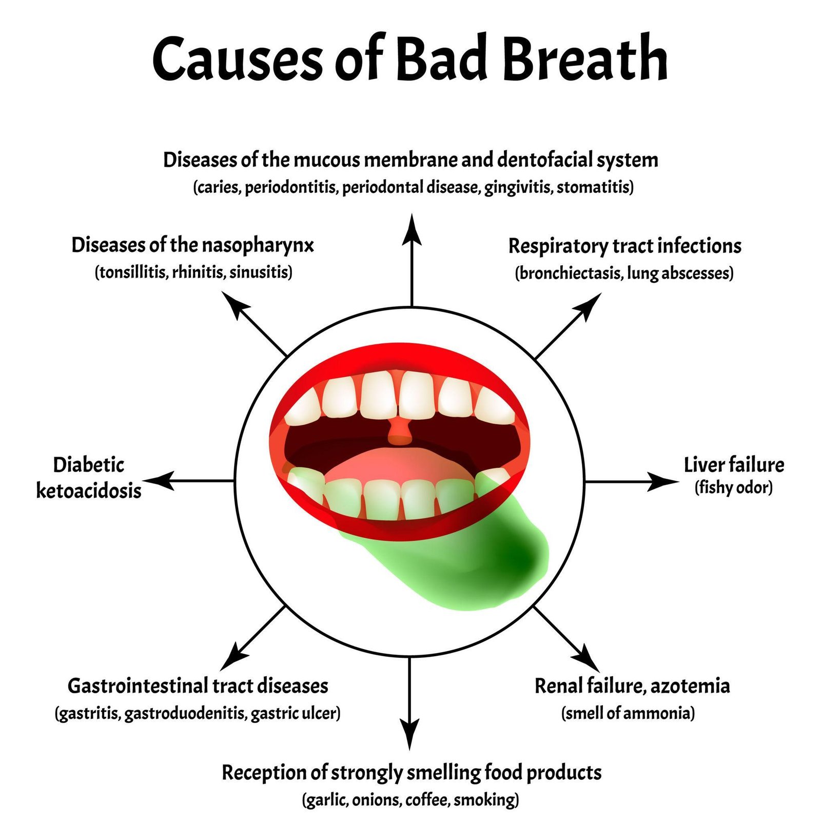 How to Get Rid of Bad Breath Permanently